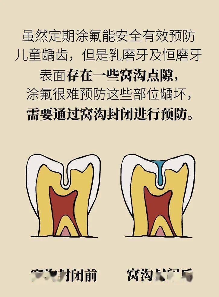 最新防蛀牙技术，开启口腔健康新篇章